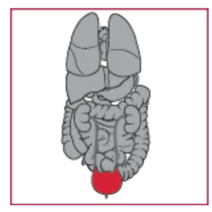 A graphic image showing organs in a person, with the bladder colored red.