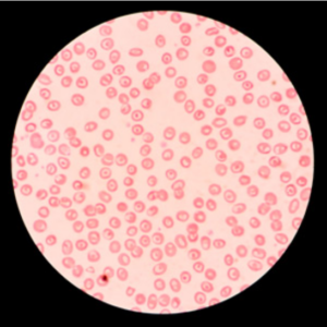 An image of cells under a microscope